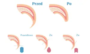 Ilustracja pokazuje, jak obciąć pazury psu który się wyrywa. Prawidłowe cięcie jest pokazane z niebieskim obcinaczem, a złe cięcie z krwawiącą kroplą lub obcinaczem zbyt blisko nerwu.