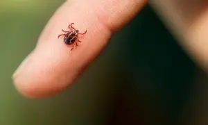 Mały kleszcz na palcu. Czy urwany kleszcz żyje? To pytanie nurtuje wielu po usunięciu pasożyta.