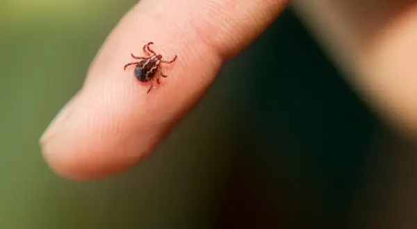 Mały kleszcz na palcu. Czy urwany kleszcz żyje? To pytanie nurtuje wielu po usunięciu pasożyta.