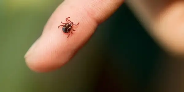 Mały kleszcz na palcu. Czy urwany kleszcz żyje? To pytanie nurtuje wielu po usunięciu pasożyta.